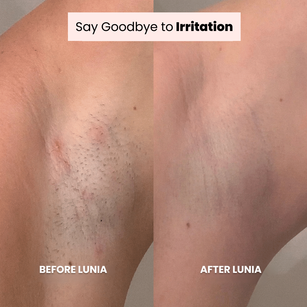 Lunia® Shaver + FREE exfoliating glove