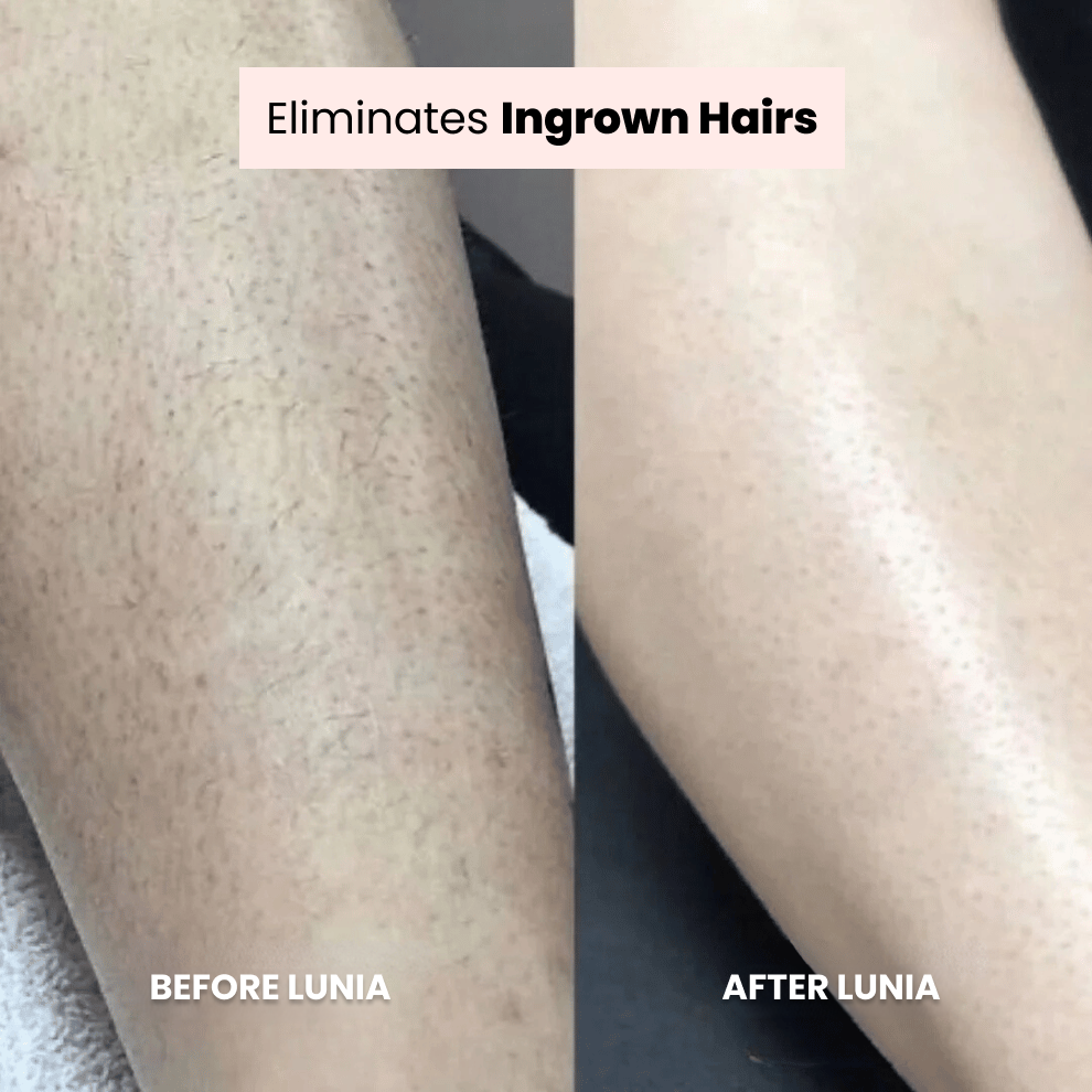 Lunia® Shaver + FREE exfoliating glove